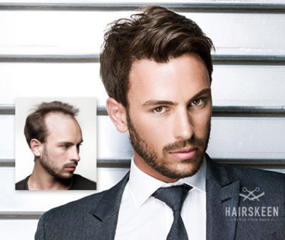 Hairskeen Men's Non-Surgical Hair Replacement | PLEIJ Salon + Spa